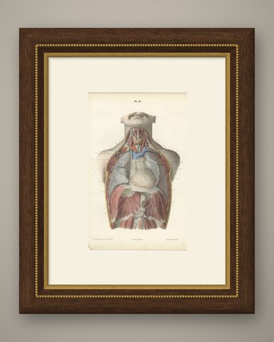 The Phrenic Nerves and the Opened Thorax, Antique Hirschfeld Anatomy Print, 1866, shown framed