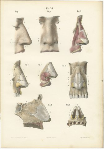 The External Nose and Its Cartilages, Antique Hirschfeld Anatomy Print, 1866, view 2