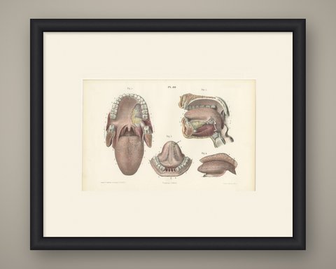 The Mouth, Tongue and Salivary Glands, Antique Hirschfeld Anatomy Print, 1866, shown framed