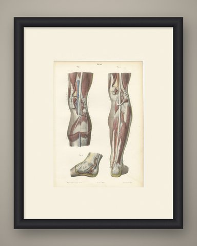 The Popliteal Region and the Calf, Antique Hirschfeld Anatomy Print, 1866, shown framed