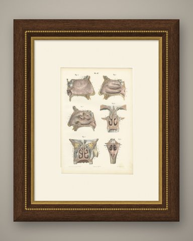 The Lining Membrane of the Nose, Antique Hirschfeld Anatomy Print, 1866, shown framed