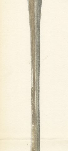 Spinal Cord and Its Serial Sections, Hirschfeld Double Folding Plate, 1866, view 4