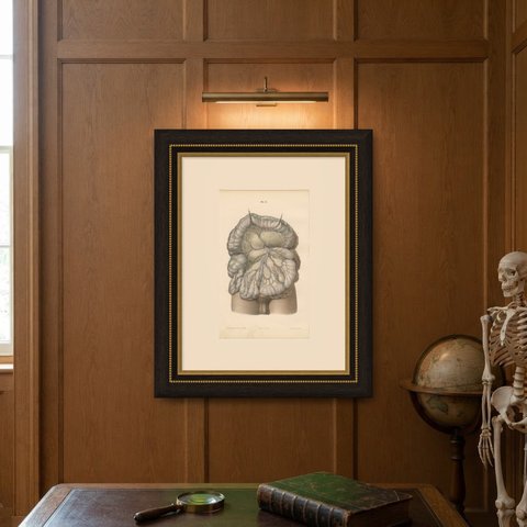 Nerves of the Mesentery and Intestine, Antique Hirschfeld Anatomy Print, 1866, shown framed on a wall