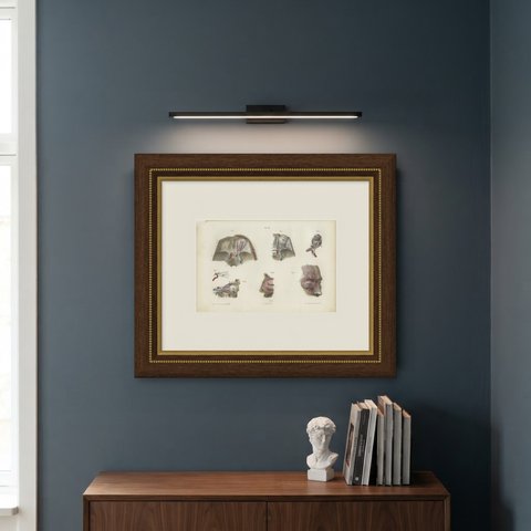 The Orbit and the Ophthalmic Nerve, Antique Hirschfeld Anatomy Print, 1866, shown framed on a wall