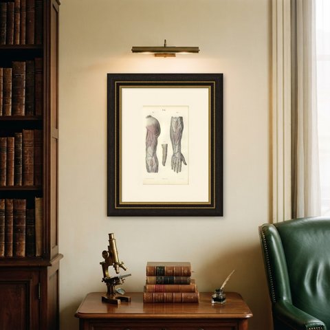 Nerves of the Back of the Arm and Hand, Antique Hirschfeld Anatomy Print, 1866, shown framed on a wall