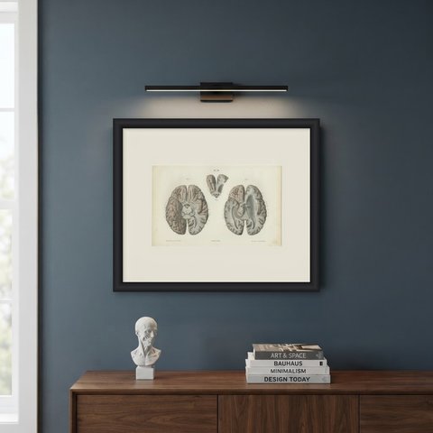 The Base of the Brain Dissected, Antique Hirschfeld Anatomy Print, 1866, shown framed on a wall