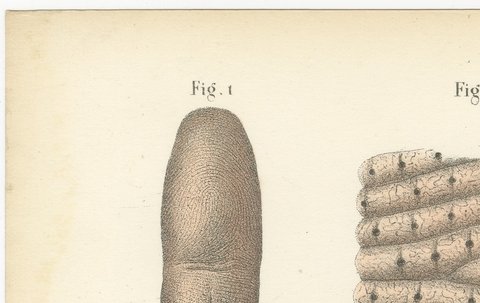 The Skin, Nail and Hair Follicle, Antique Hirschfeld Anatomy Print, 1866, view 3