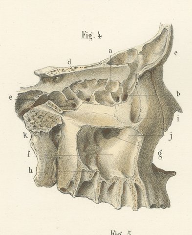 The Bony Nasal Cavity, Antique Hirschfeld Anatomy Print, 1866, view 5
