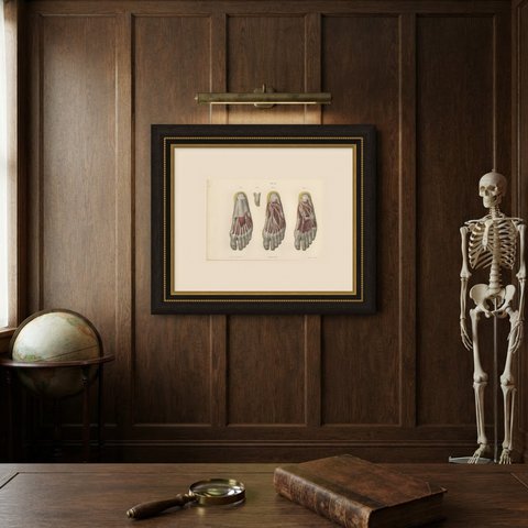 The Sole of the Foot in Four Layers, Antique Hirschfeld Anatomy Print, 1866, shown framed on a wall