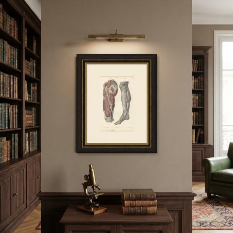Nerves of the Hip and Lower Limb, Antique Hirschfeld Anatomy Print, 1866, shown framed on a wall