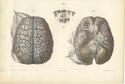 Veins of the Cerebral Hemispheres, Antique Hirschfeld Anatomy Print, 1866, view 2