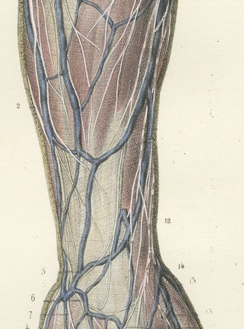 Nerves of the Back of the Arm and Hand, Antique Hirschfeld Anatomy Print, 1866, view 6