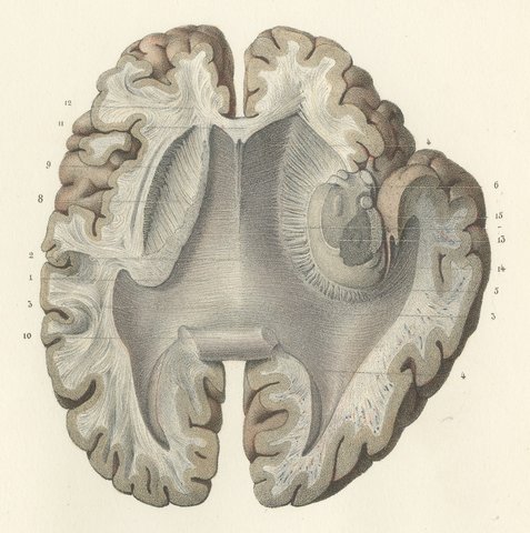 Horizontal Sections of the Cerebrum, Antique Hirschfeld Anatomy Print, 1866, view 4