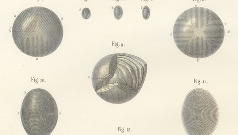 The Crystalline Lens, Antique Hirschfeld Anatomy Print, 1866, view 4