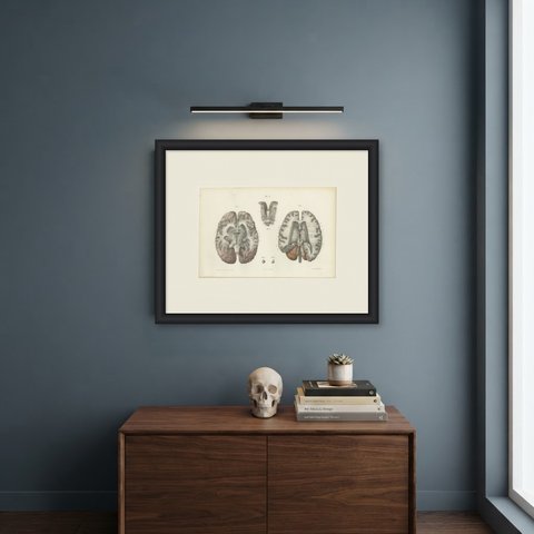 The Lateral Ventricles Opened, Antique Hirschfeld Anatomy Print, 1866, shown framed on a wall