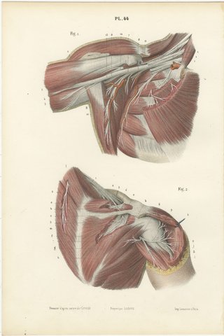 The Axilla and the Cords of the Plexus, Antique Hirschfeld Anatomy Print, 1866, view 2