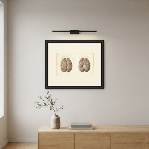 The Whole Brain from Above and Below, Antique Hirschfeld Anatomy Print, 1866, shown framed on a wall
