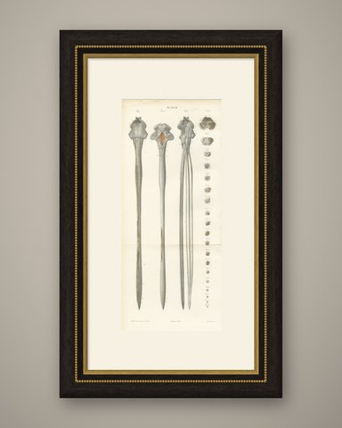 Spinal Cord and Its Serial Sections, Hirschfeld Double Folding Plate, 1866, shown framed
