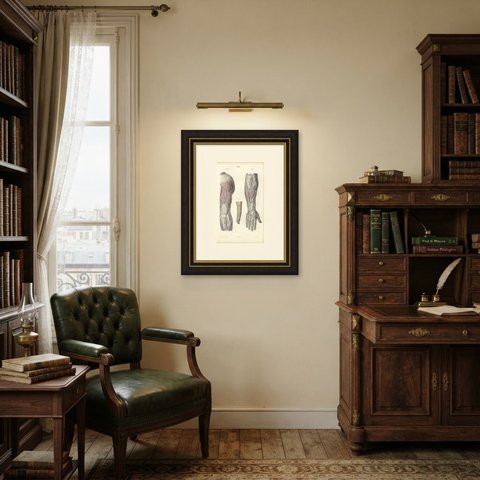 Nerves of the Back of the Arm and Hand, Antique Hirschfeld Anatomy Print, 1866, shown framed in a room