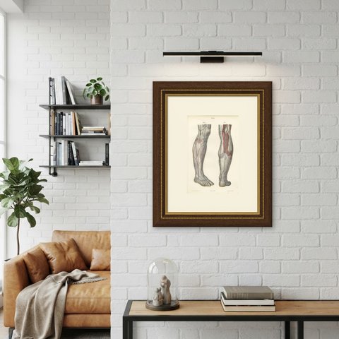 Nerves of the Leg and Foot, Antique Hirschfeld Anatomy Print, 1866, shown framed on a wall