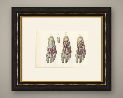 The Sole of the Foot in Four Layers, Antique Hirschfeld Anatomy Print, 1866, shown framed