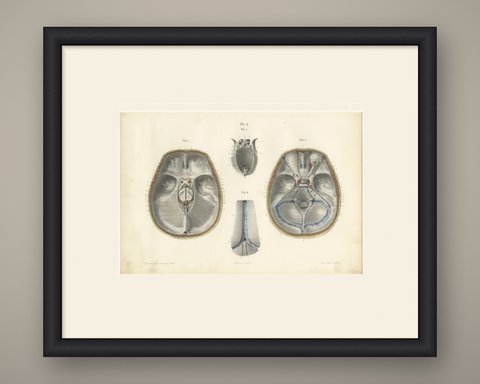 The Base of the Skull and Its Dural Folds, Hirschfeld Anatomy Print, 1866, shown framed