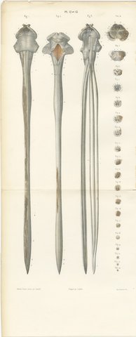 Spinal Cord and Its Serial Sections, Hirschfeld Double Folding Plate, 1866, view 2