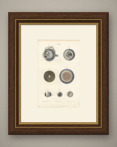 The Choroid, Iris and Retina, Antique Hirschfeld Anatomy Print, 1866, shown framed