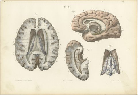 The Fornix and Choroid Plexus, Antique Hirschfeld Anatomy Print, 1866, view 2