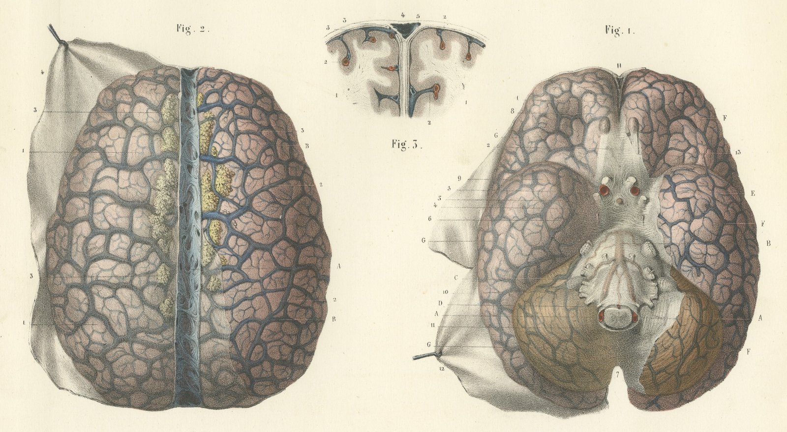 Veins of the Cerebral Hemispheres, Antique Hirschfeld Anatomy Print, 1866