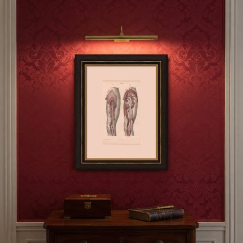 The Sciatic Nerve in the Thigh, Antique Hirschfeld Anatomy Print, 1866, shown framed on a wall
