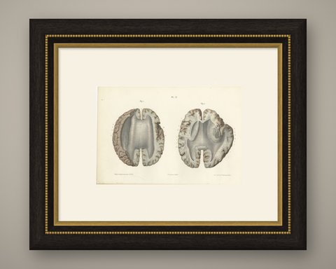 Horizontal Sections of the Cerebrum, Antique Hirschfeld Anatomy Print, 1866, shown framed