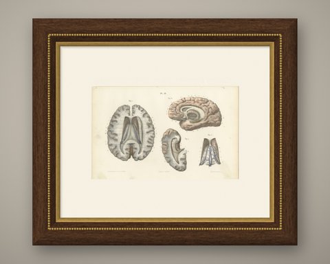 The Fornix and Choroid Plexus, Antique Hirschfeld Anatomy Print, 1866, shown framed