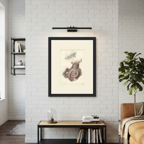 The Brachial Plexus, Antique Hirschfeld Anatomy Print, 1866, shown framed on a wall