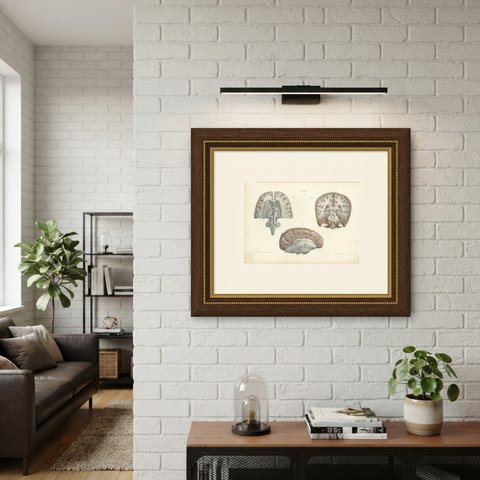 Coronal Section of the Head, Antique Hirschfeld Anatomy Print, 1866, shown framed on a wall