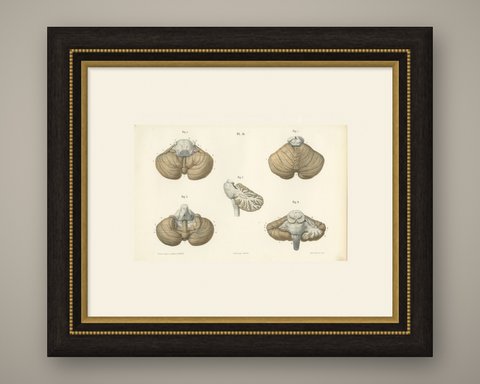 The Cerebellum, Antique Hirschfeld Anatomy Print, 1866, shown framed