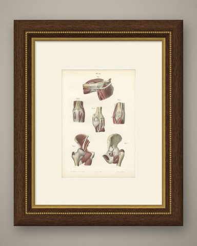 Nerves of the Joints, Antique Hirschfeld Anatomy Print, 1866, shown framed
