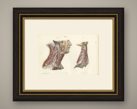 The Cervical Plexus, Antique Hirschfeld Anatomy Print, 1866, shown framed