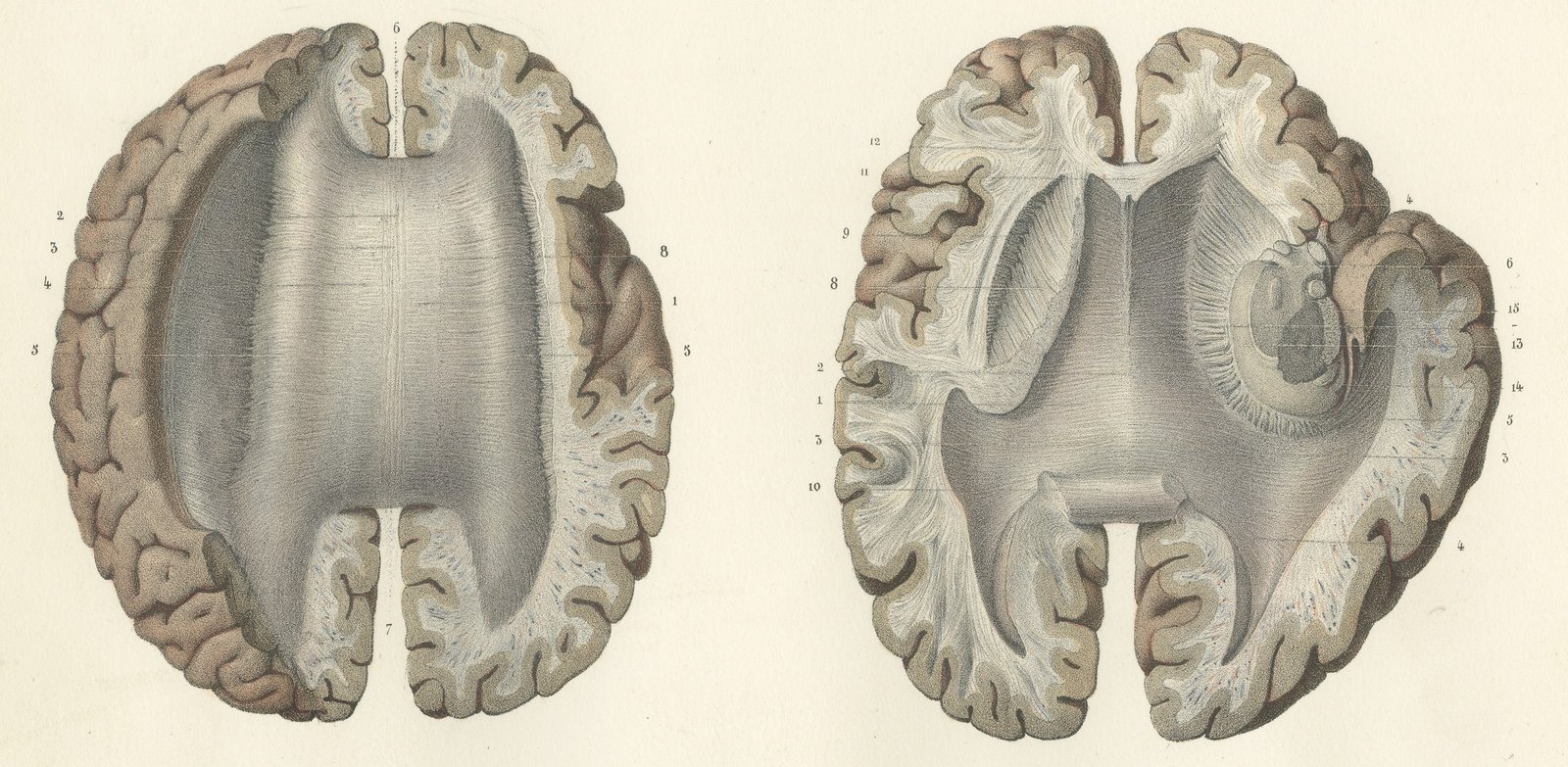 Horizontal Sections of the Cerebrum, Antique Hirschfeld Anatomy Print, 1866