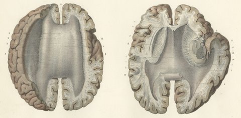 Horizontal Sections of the Cerebrum, Antique Hirschfeld Anatomy Print, 1866