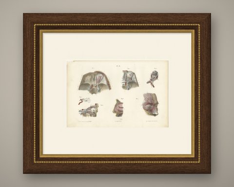 The Orbit and the Ophthalmic Nerve, Antique Hirschfeld Anatomy Print, 1866, shown framed